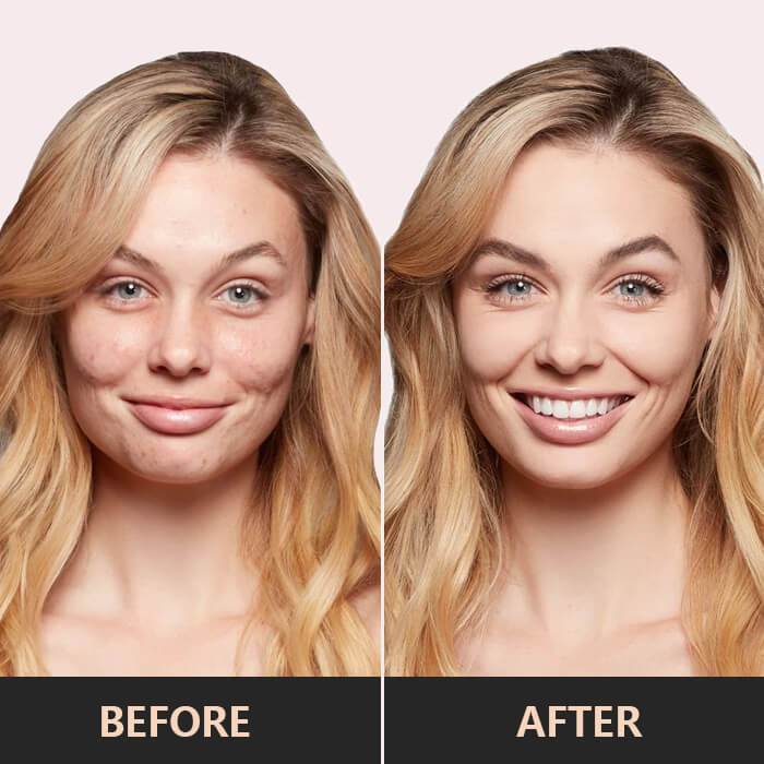 NudeBlend™ Instant Blemish Conceal