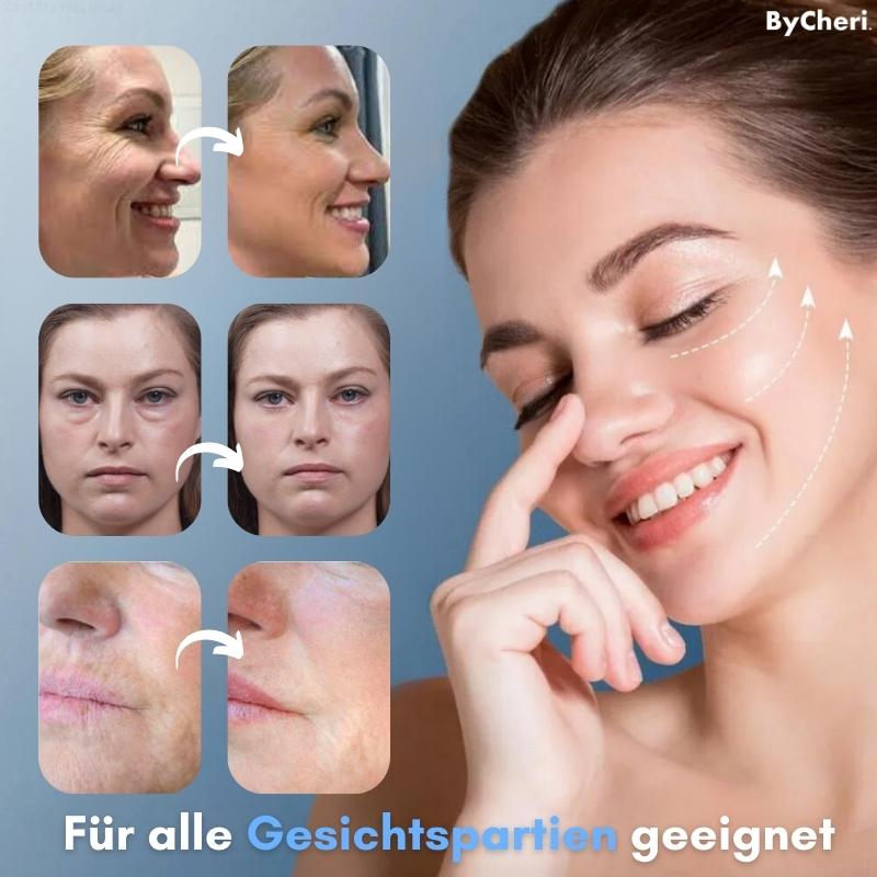 FreshEyes™ Soften Dark Circles In Seconds
