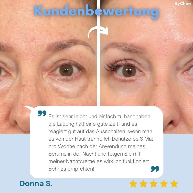FreshEyes™ Soften Dark Circles In Seconds