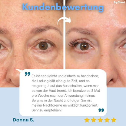 FreshEyes™ Soften Dark Circles In Seconds