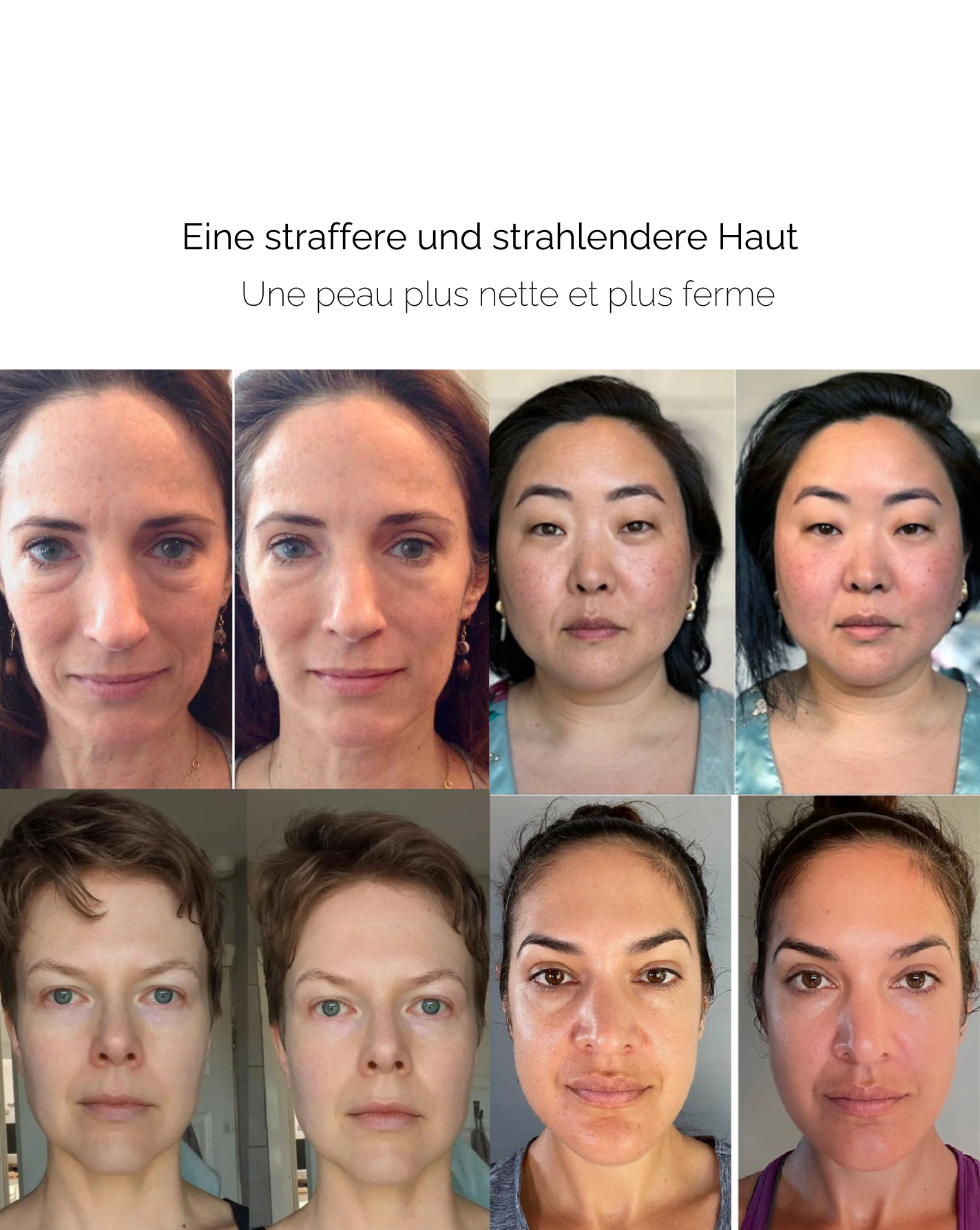 YouthRoll™ Youthful Glow Booster