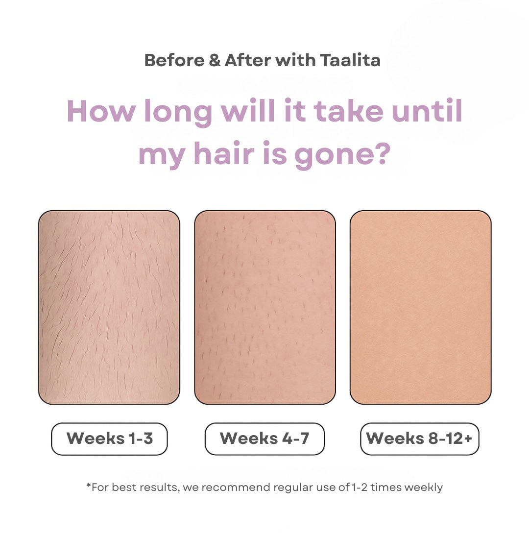Taalitas IPL Hair Remover I The leading laser hair removal for your home