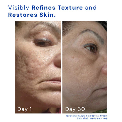 Retinol Face Cream 12$ TODAY ONLY