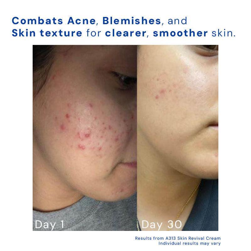 Retinol Face Cream 12$ TODAY ONLY