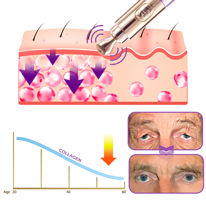 TheraPen™ Therapy Electric Serum Pen