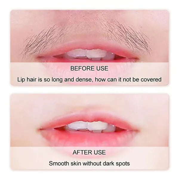 SilkErase – Gentle & Painless Facial Hair Removal Cream