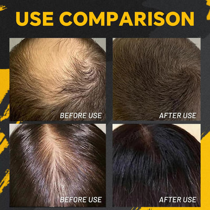 PowderLocks Hair Powder | BUY 1 GET 1 FREE (2PCS)