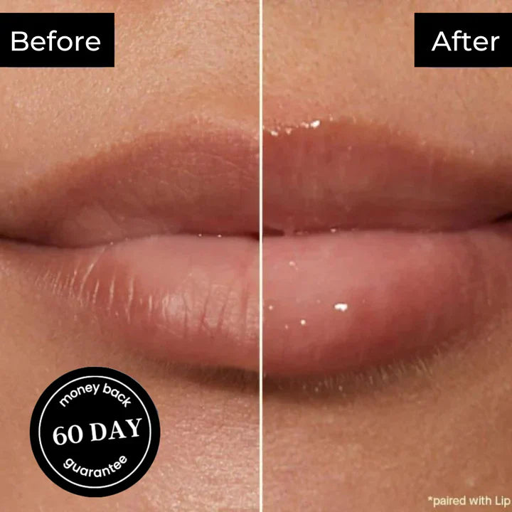 Derol Lip Plumper Set