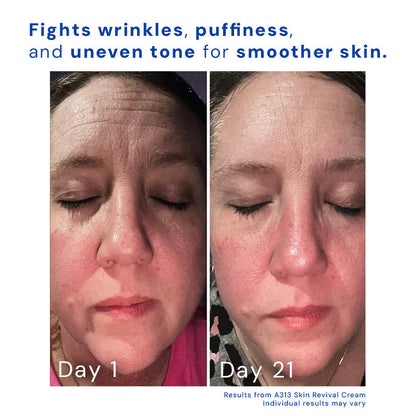 Retinol Face Cream 12$ TODAY ONLY