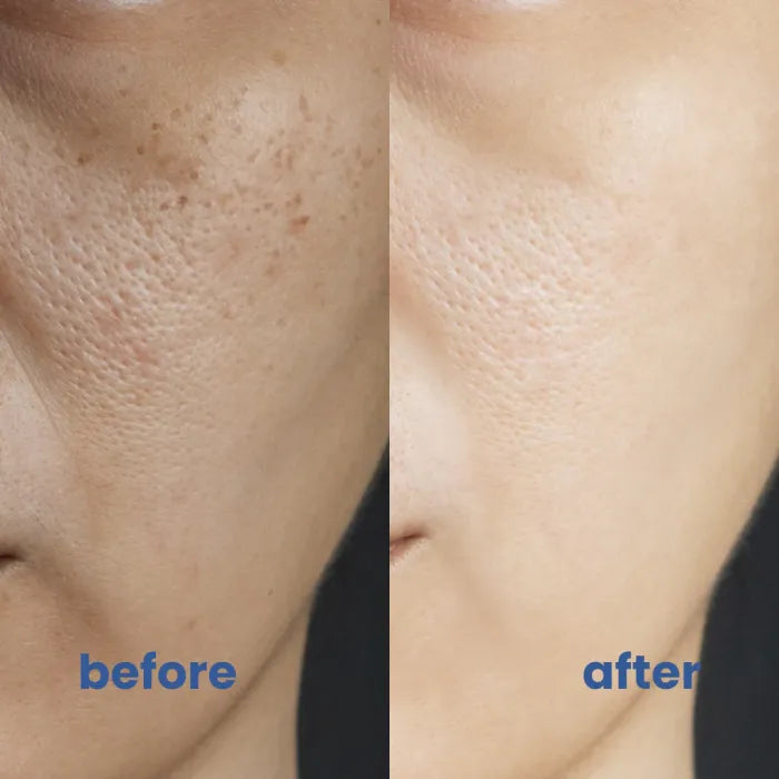 SkinGlow™ Flawless Coverage Solution